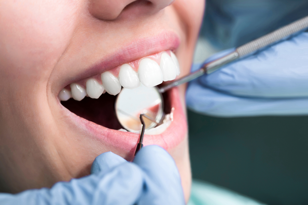 Dentista em Formosa