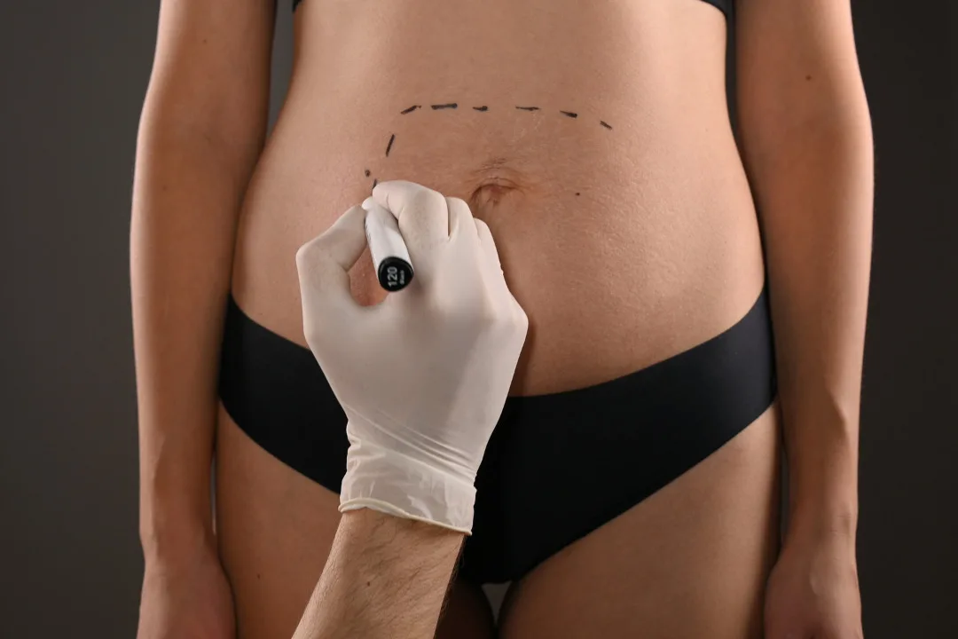 Como Divulgar Seus Serviços De Cirurgia Plástica | Você Administra Uma Clínica De Cirurgia Plástica? Se Sim, Aqui Estão 20 Ideias Poderosas Sobre Como Comercializar Seus Serviços De Cirurgia Plástica E Estética Para Clientes De Alto Potencial.