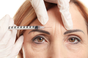 Botox: Verdades e Mitos que Você Precisa Saber Antes de Fazer o Procedimento